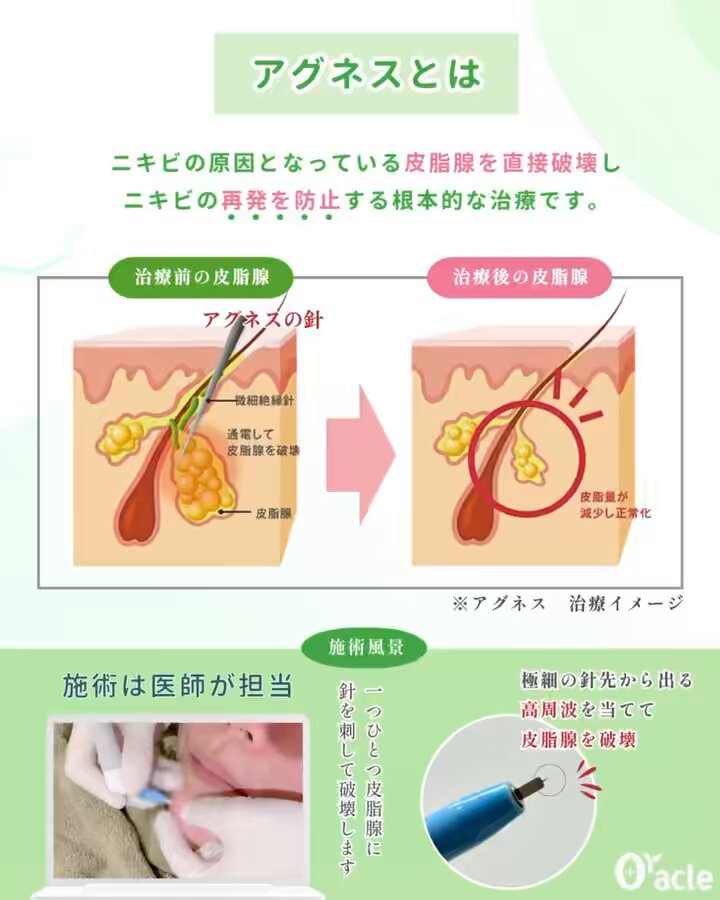 Oracle美容皮膚科と同じものです✴︎ オラクル美容皮膚科【公式】 (@oracleclinic) / X