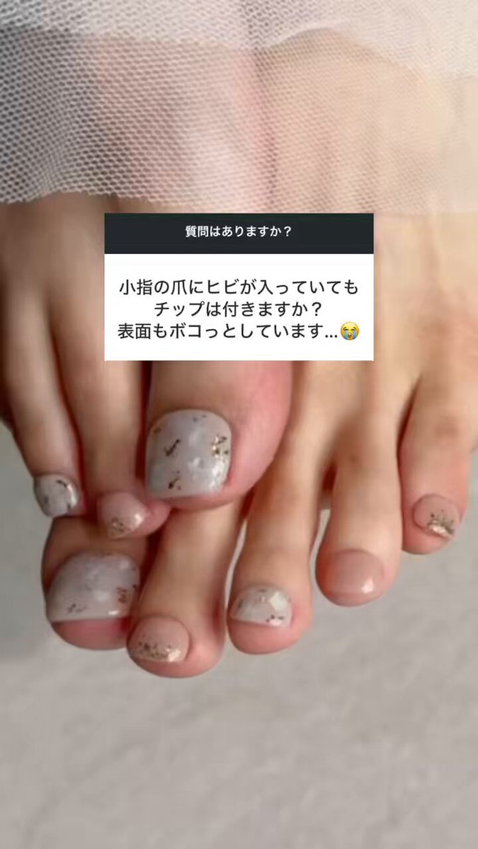 EVER NAIL公式-繰り返し使えるジェルネイル- (@EVERNAIL_) / X
