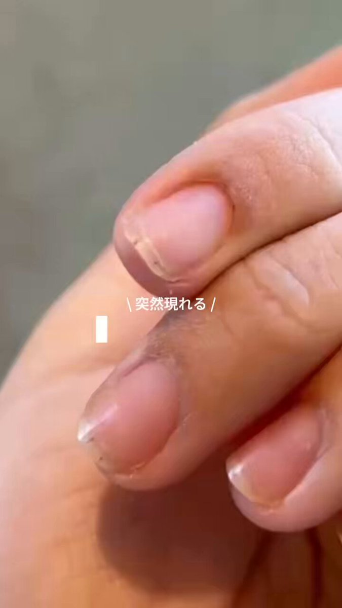 リピネイル エバーネイル ネイルグルー5本セット 繰り返し使えるネイル EVER NAIL｜エバーネイル
