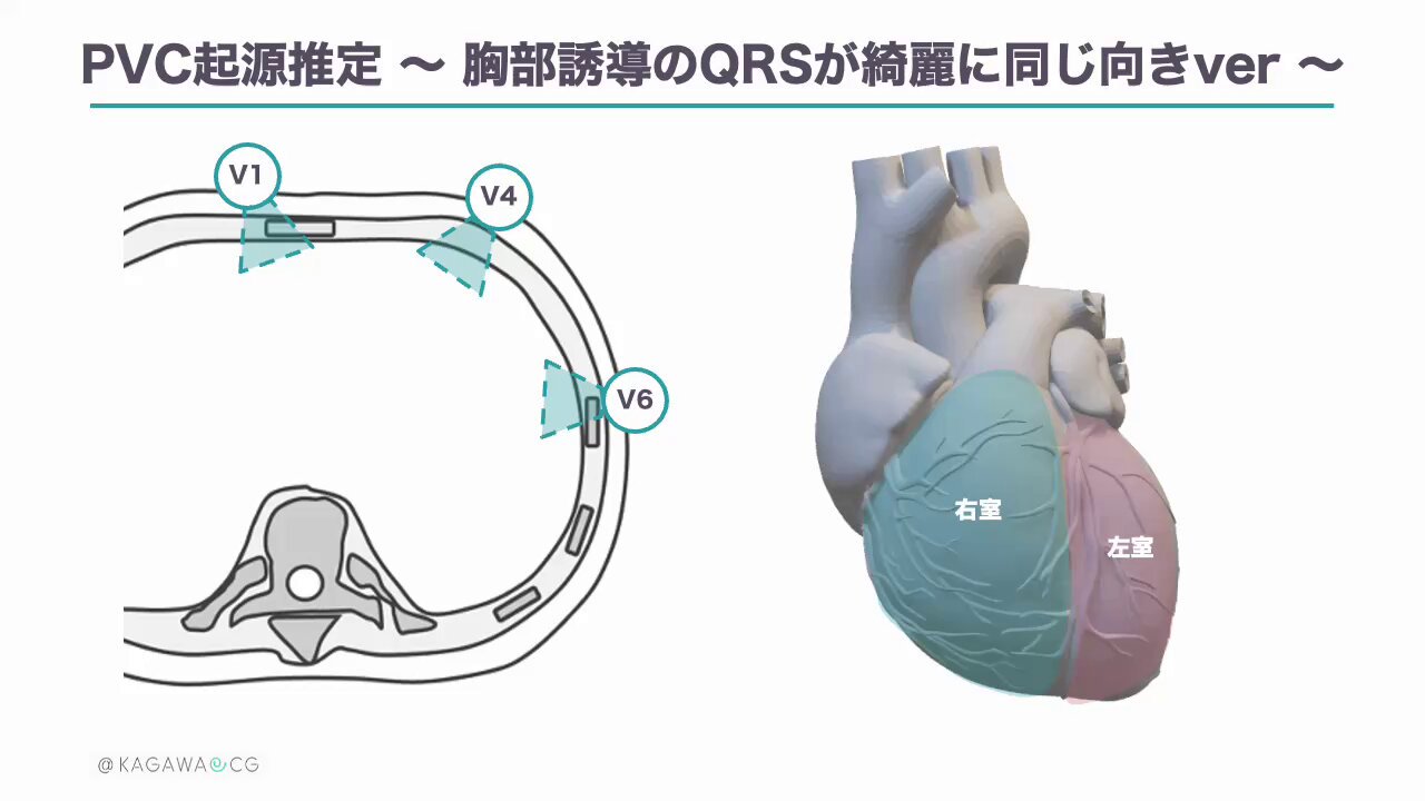 ちなみ　心電図ハンタ－ 1&amp;2 71wttYrBElL._UF350,350_QL50_.jpg