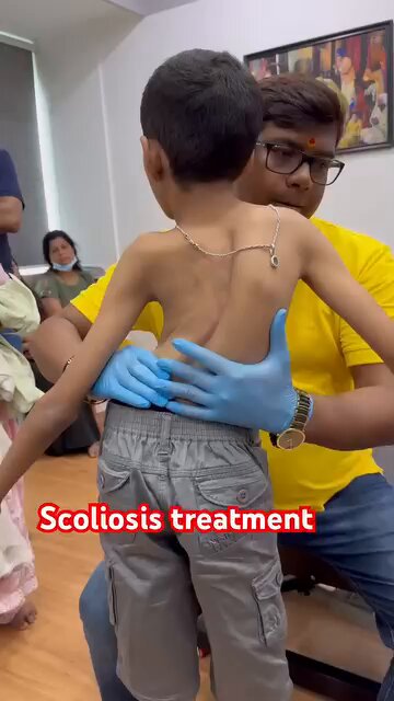 الجنف هو انحناء جانبي غير طبيعي في العمود الفقري، حيث يبدو العمود الفقري مقوسًا بشكل حرف "S" أو "C" عند النظر إليه من الخلف بدلاً من أن يكون مستقيمًا. يُعرف الجنف أيضًا باسم "سكوليوز" 