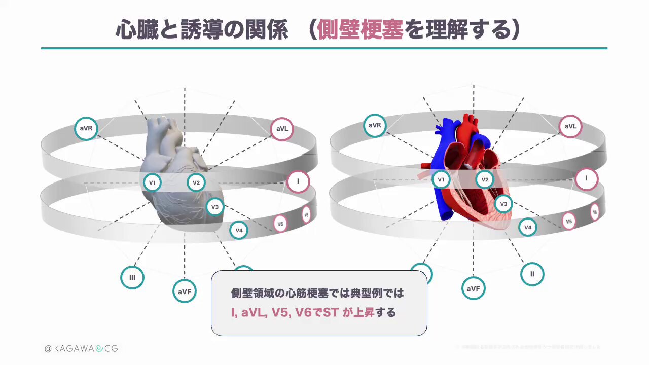 ちなみ　心電図ハンタ－ 1&amp;2 Amazon.com: 心電図ハンター 心電図×非循環器医 2失神・動悸