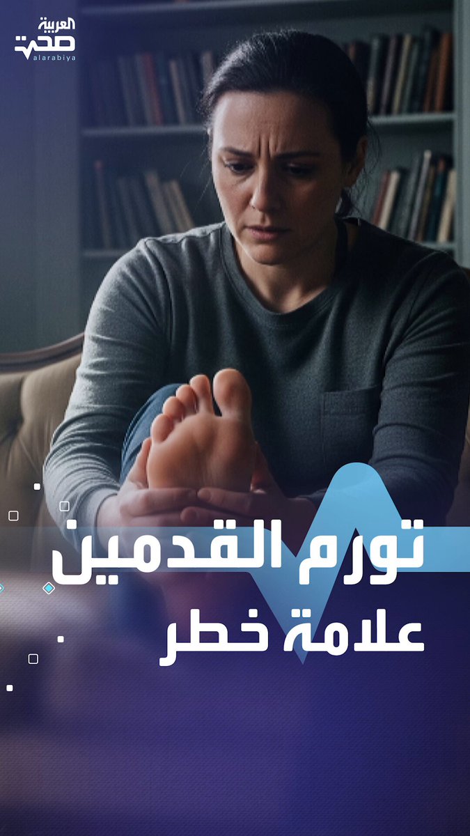تورم القدمين قد يكون أول إنذار لا تهمله! صحة _صحة 