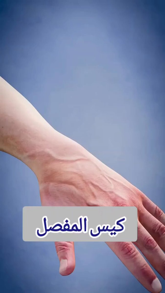 ما هو كيس المفصل وما علاجه ؟ 