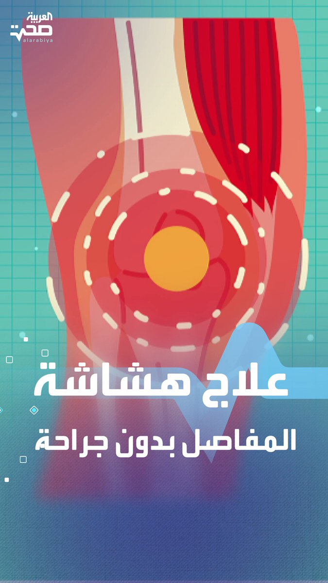تقنية جديدة تخفف ألم هشاشة الركبة بدون جراحة _صحة #صحة 