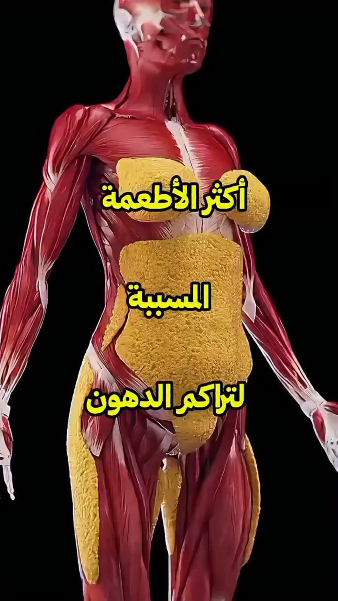 أكثر الأطعمة المسببة لتراكم الدهون 