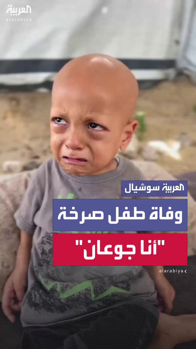 لم يسعفه العلاج بعد تأخره وسوء حالته الصحية.. وفاة الطفل الغزي صاحب صرخة "أنا جوعان" 