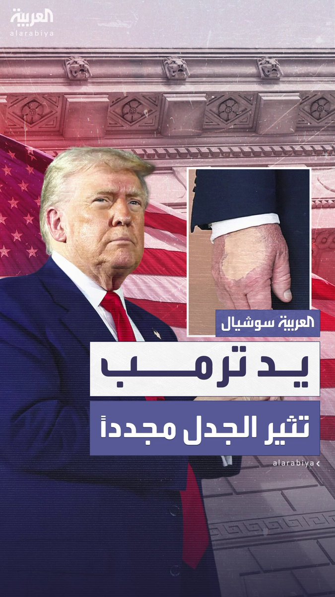 التقطتها عدسات الكاميرا في آخر ظهور له.. يد الرئيس ترمب تثير الجدل والتساؤلات مجدداً #أميركا 