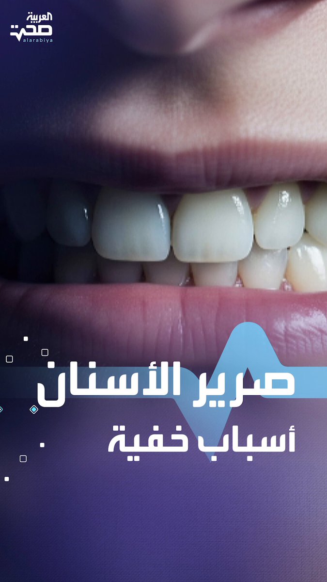 تعاني من صرير الأسنان ليلا.. إليك أهم الأسباب صحة _صحة 