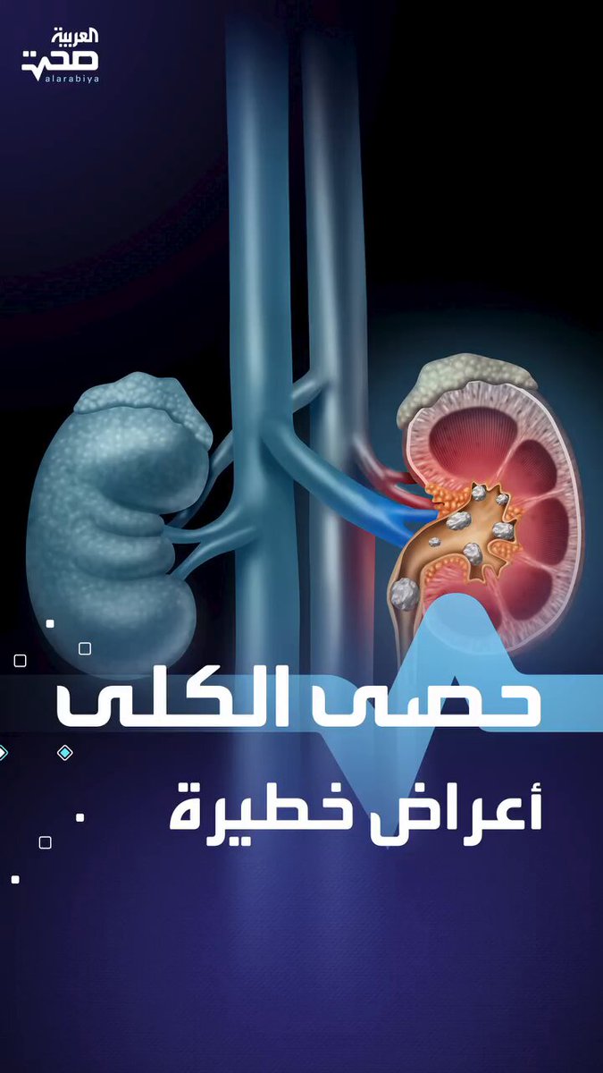إحذر ألم الظهر !!؟ 