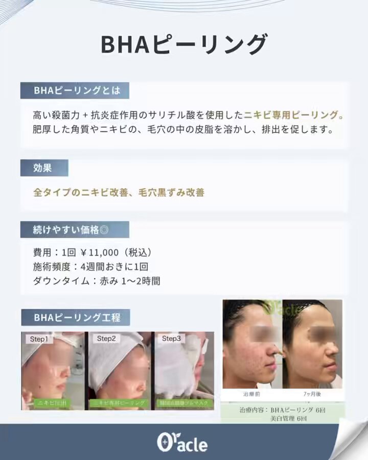 Oracle美容皮膚科と同じものです✴︎ チョンダムオラクル皮膚科 (@oraclecliniccd_jp) • Instagram