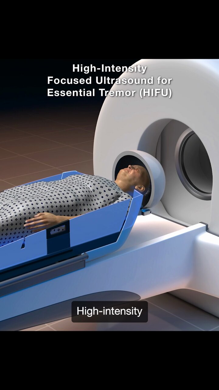 UCSF Neurosurgery on X: 