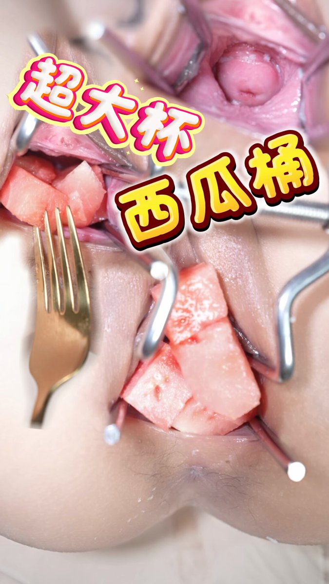 媒体预览