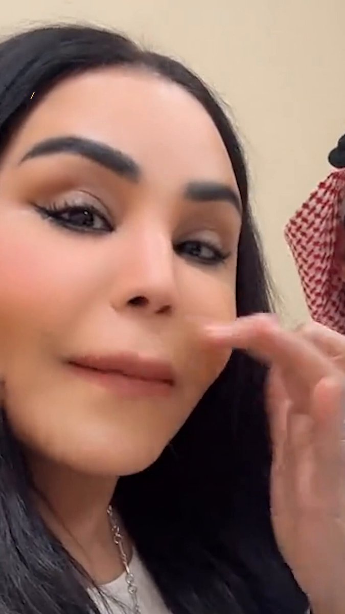 أحلام تكشف عبر سناب شات عن خضوعها قبل 3 أشهر لعملية تجميل في الأنف ترافقت مع تعديل وتصحيح للتنفس وذلك خلال استعراضها النتيجة 