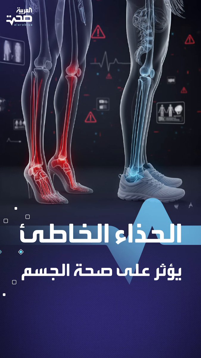 الحذاء الخاطئ يؤثر على صحة الجسم صحة _صحة 