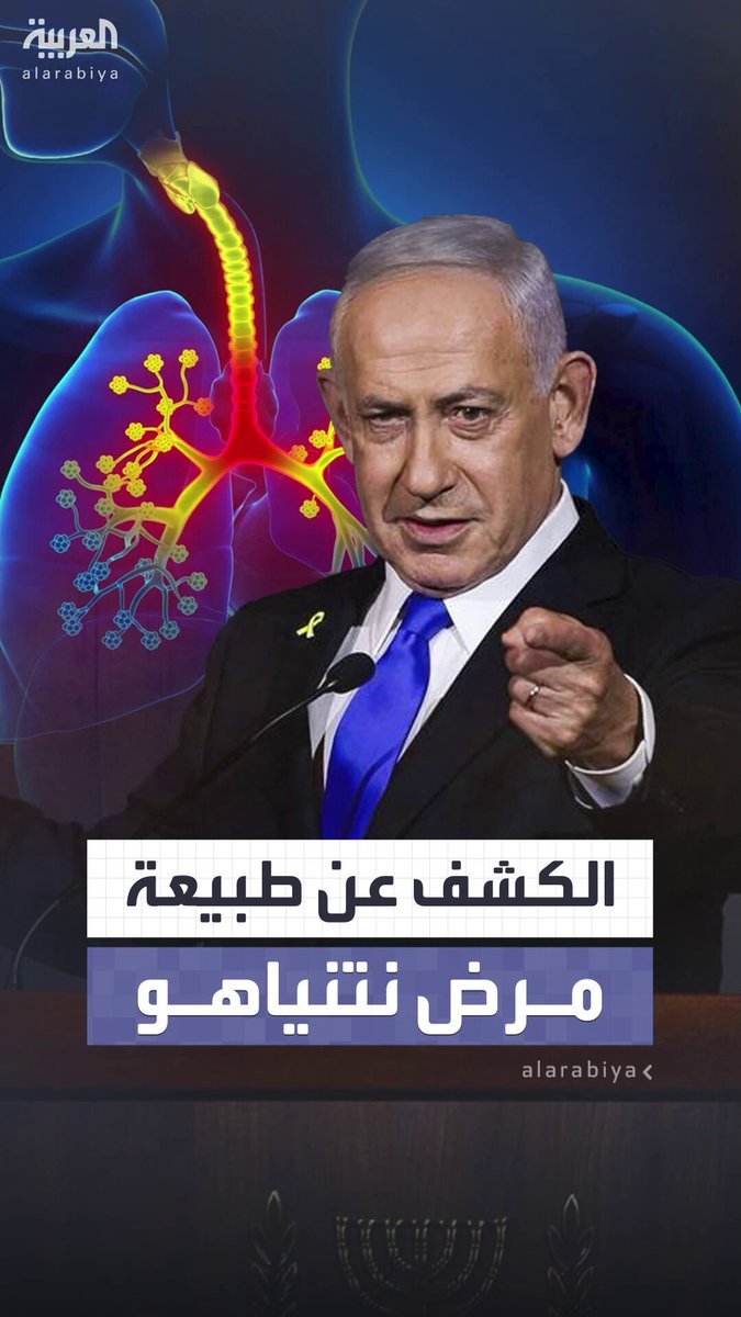 يعاني التهاباً في القصبة الهوائية والأطباء أوصوه بالراحة.. الحكومة الإسرائيلية تكشف طبيعة مرض نتنياهو يعاني التهاباً في القصبة الهوائية والأطباء أوصوه بالراحة.. الحكومة الإسرائيلية تكشف طبيعة مرض نتنياهو
