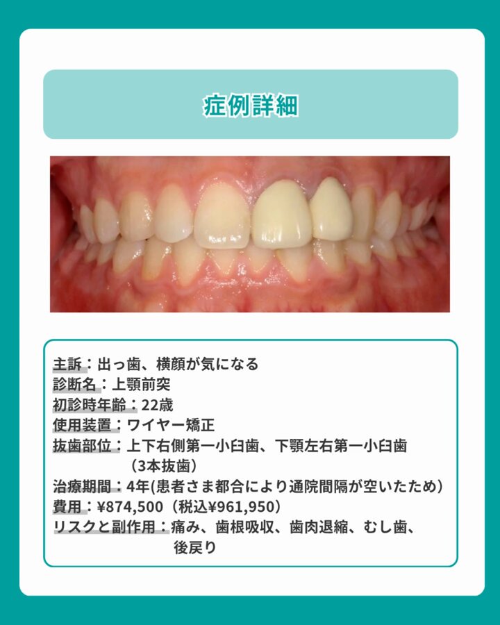 歯科矯正 - Search / X