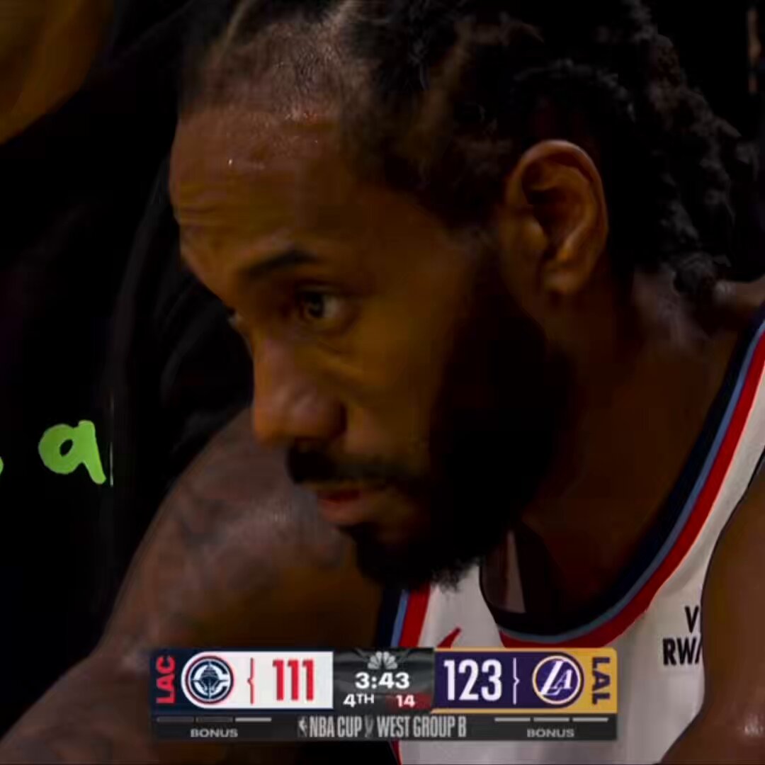 Kawhi Leonard was enraged during the Dunn-Luka-Hayes scuffle!

