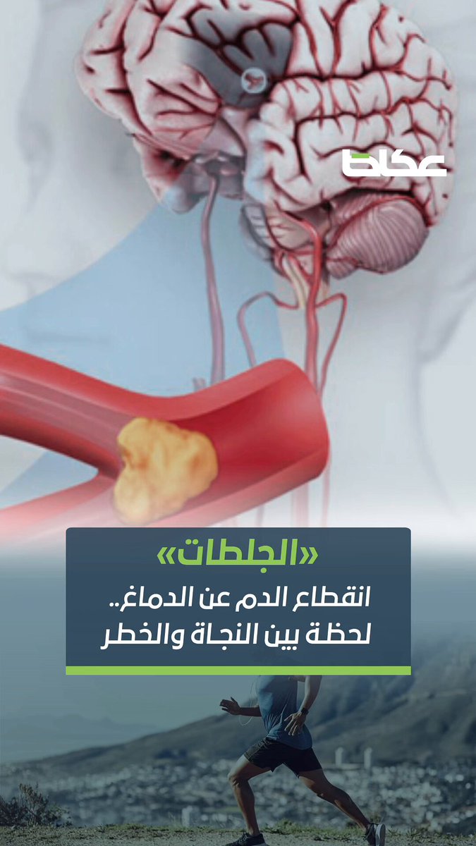 فيديو | «الجلطات».. انقطاع الدم عن الدماغ قد يستغرق ثوان لكنه يغيّر الحياة للأبد.. وسرعة التدخل تصنع الفارق.. إعداد: خالد الحارثي. مونتاج 