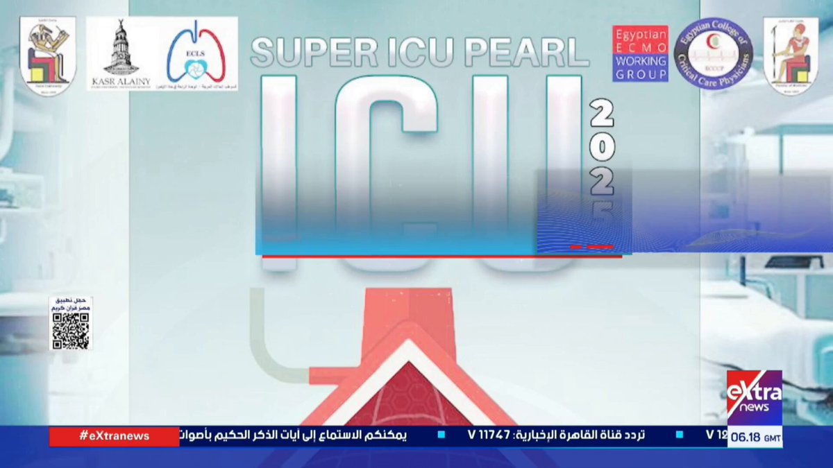 قصر العيني ومبادرة إنتاج أول جهاز مصري ECMO #هذا_الصباح 