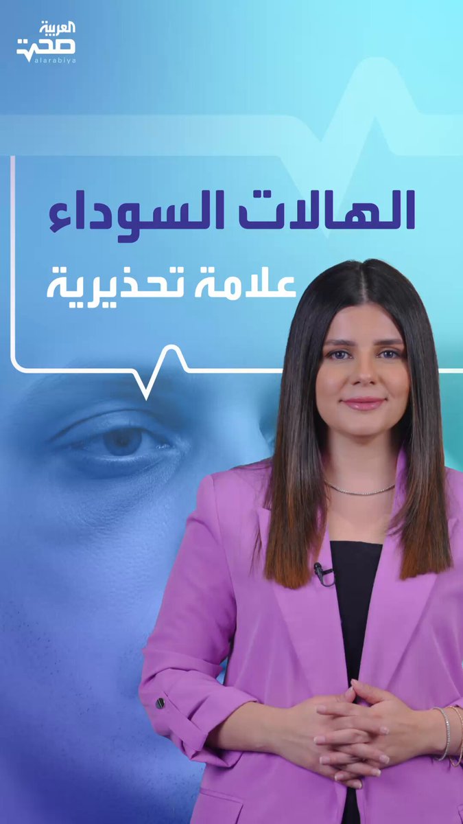 الهالات السوداء تحت العينين.. مؤشّر لأمراض خفية صحة _صحة 