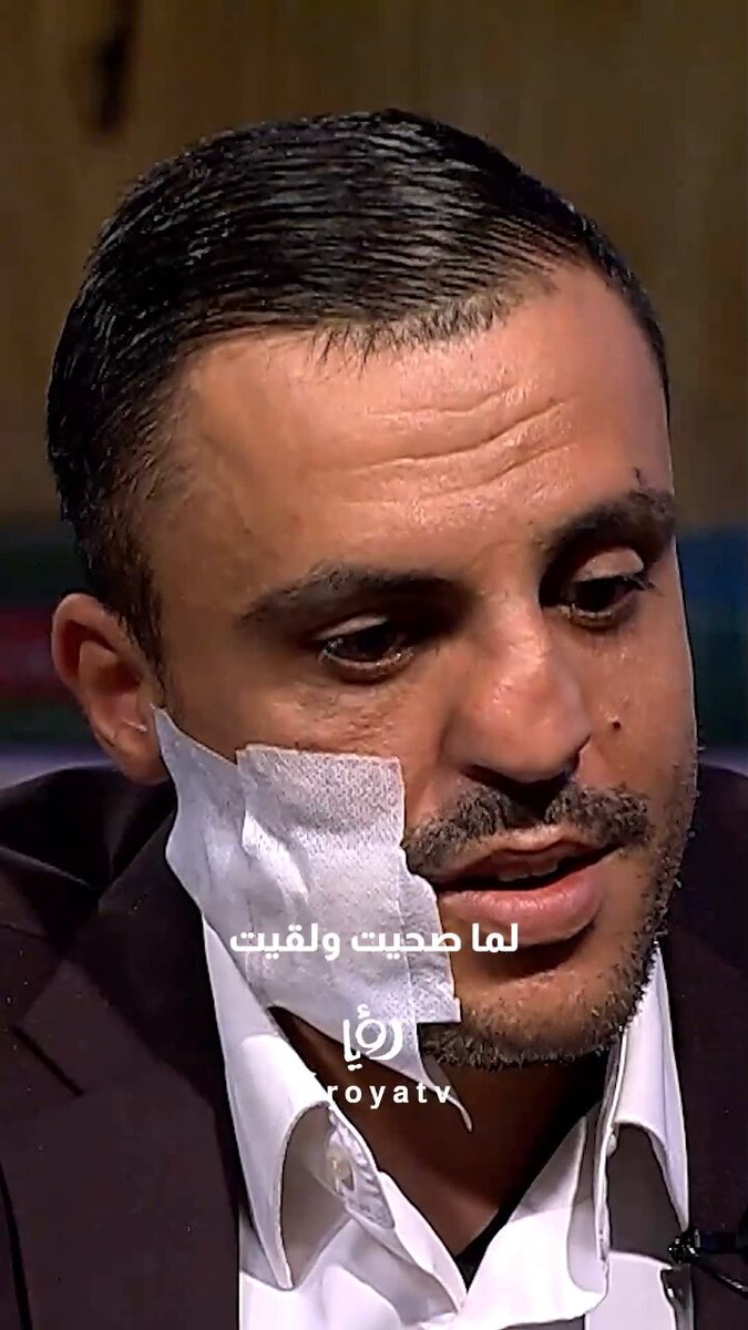 شخص من ذوي الإعاقة تعرض للضرب في الوجه و22 قطبة لكن المفاجأة من برنامج بين قوسين من خلال اتصال مع الدكتورة ريم التي قررت تكفل حالته ومعالجته. برنامج بين قوسين على شاشة رؤيا كل جمعة الساعة 7 مساء 