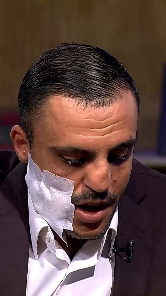 "بتطلع بالمراي وبتأثر نفسيًا يعن نفسيتي كثير تعبت". تابعوا برنامج بين قوسين كل جمعة الساعة 7 مساءً على شاشة رؤيا 