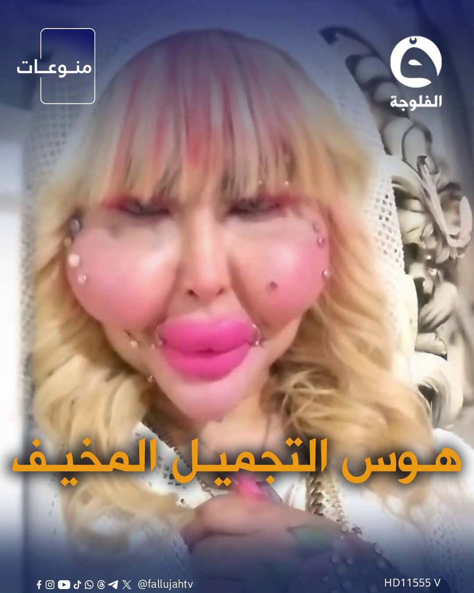 بلوكر إيرانية تخضع لـ 388 عملية تجميل وعايشة على الكهوة! قناة الفلوجة | #الفلوجة_إكسترا 