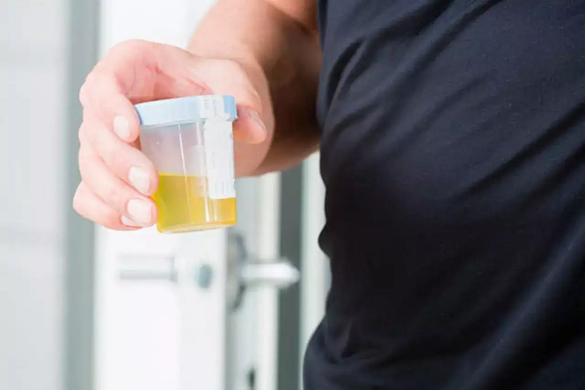 Washing Eyes With Urine Cures Diseases?
