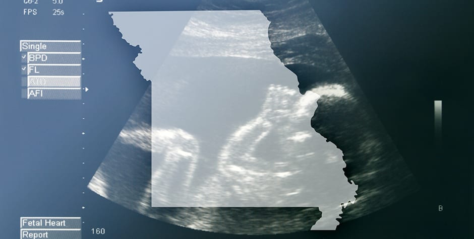 JaySekulow's tweet card. The abortion industry has taken its war on life and parental rights to a new extreme. A radical abortion advocacy group is suing to strike down Missouri’s long-established and commonsense parental...