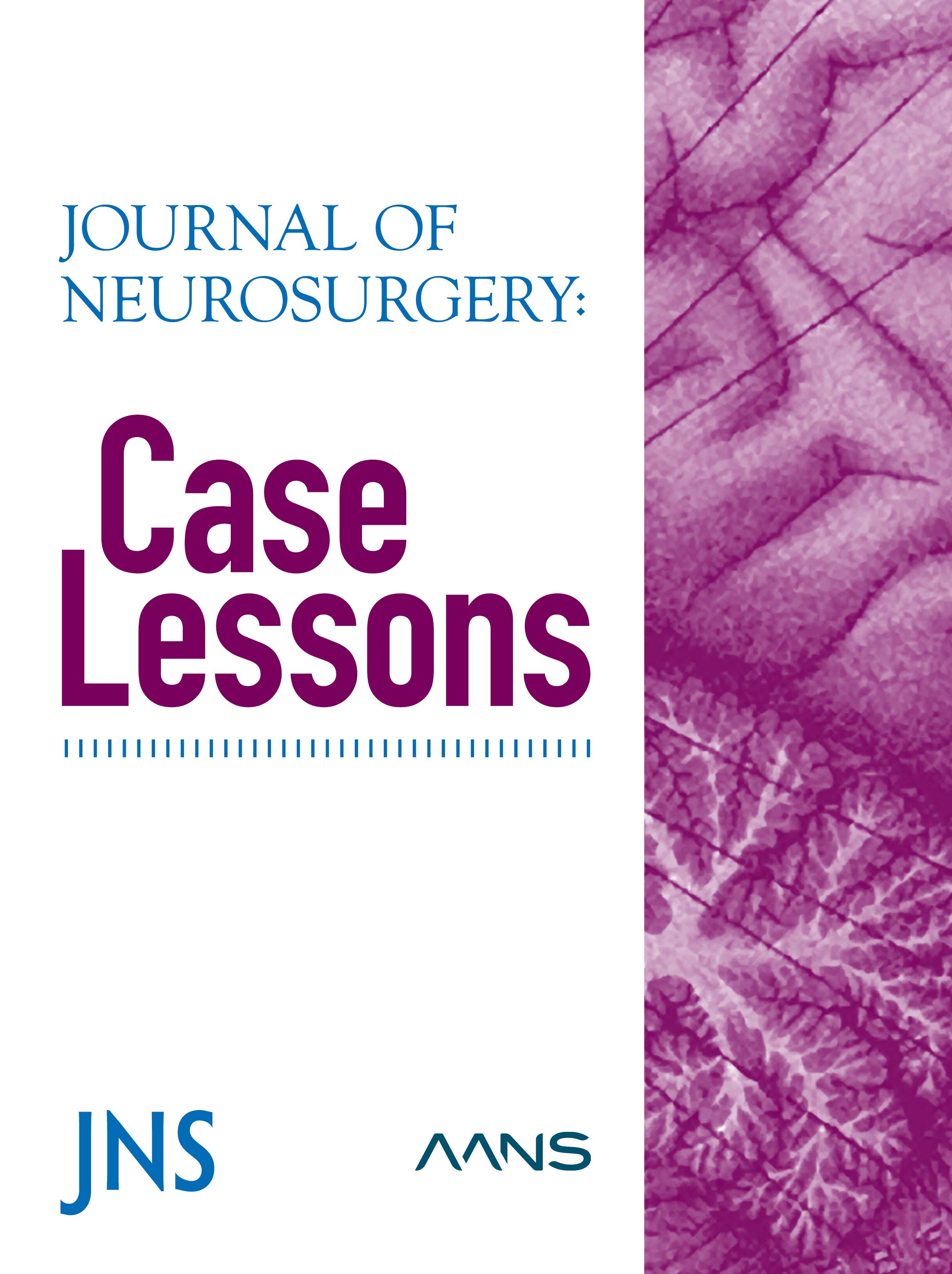 DrPJKaras's tweet card. BACKGROUND Astroblastoma is a rare neoplasm characterized as a circumscribed glial neoplasm most often arising in the frontoparietal cerebral hemispheres in older children. OBSERVATIONS We report an...