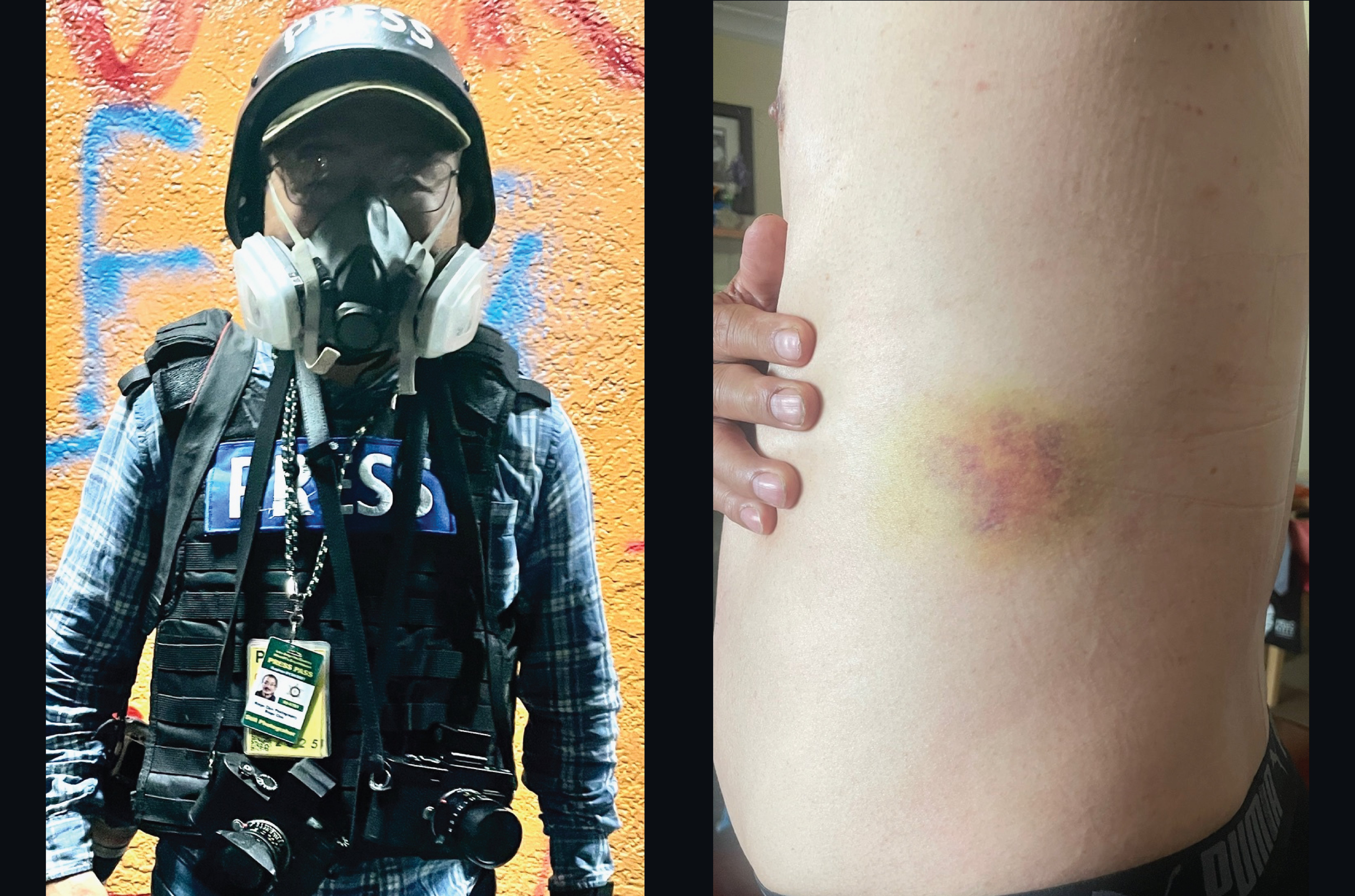 uspresstracker's tweet card. Photojournalist Ringo Chiu was hit in the waist by an impact projectile fired by Los Angeles County Sheriff’s Department deputies …