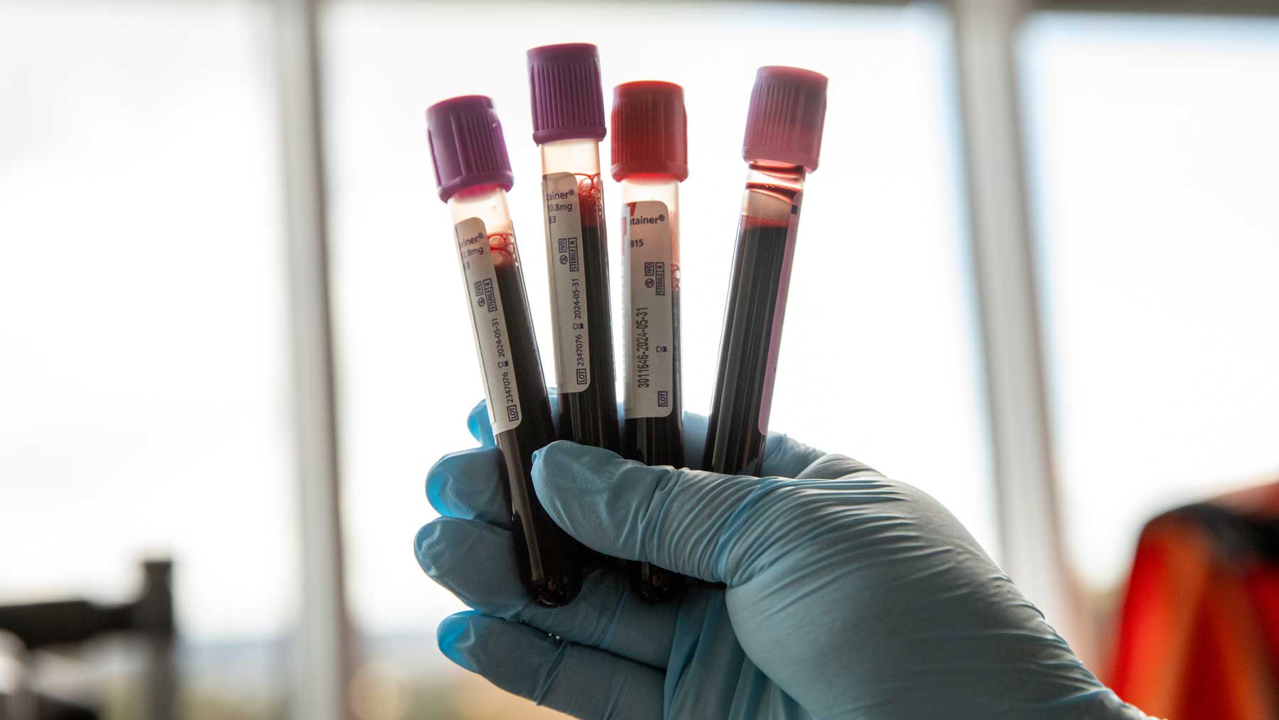 UCSF's tweet card. A professor of physiological nursing explains the differences between genetic predisposition and lifestyle factors for type 2 diabetes, and how to predict and prevent it in high-risk racial groups.