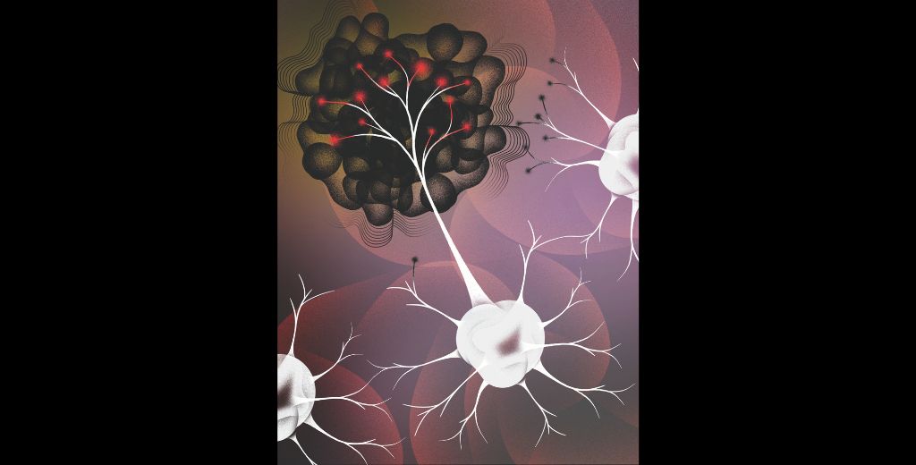 StanfordCancer's tweet card. Stanford Medicine scientists founded a new field of cancer biology by showing how cancer cells tap into the nervous system.