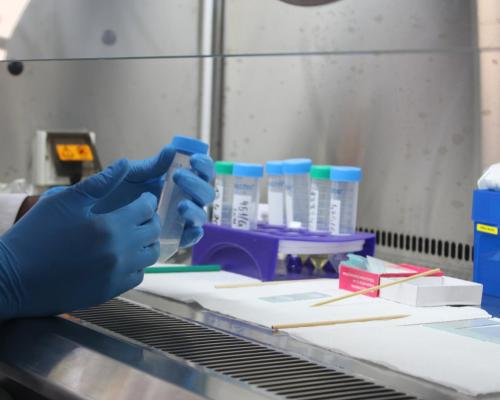 WHOAFRO's tweet card. Brazzaville – Salomon*, in his 30s, arrives for his consultation with an envelope containing the results of his laboratory tests and an x-ray of his lungs, which he hands to Amélie Makoundou, public...