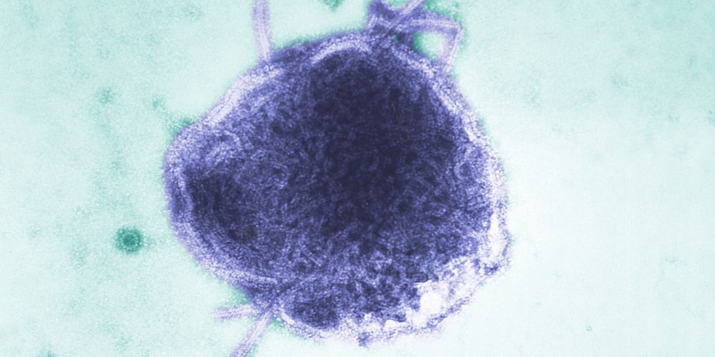 ScottGottliebMD's tweet card. There have been at least 1,309 confirmed cases of measles in the U.S. this year. Hundreds or thousands of other families have most likely had their lives upended after being exposed.