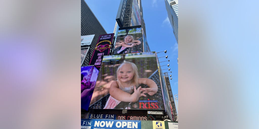 RevDeanNelson's tweet card. I’m not afraid of Down syndrome. Instead, I’m afraid of what my life might have been had we not been given my little girl Josie. She’s perfect.