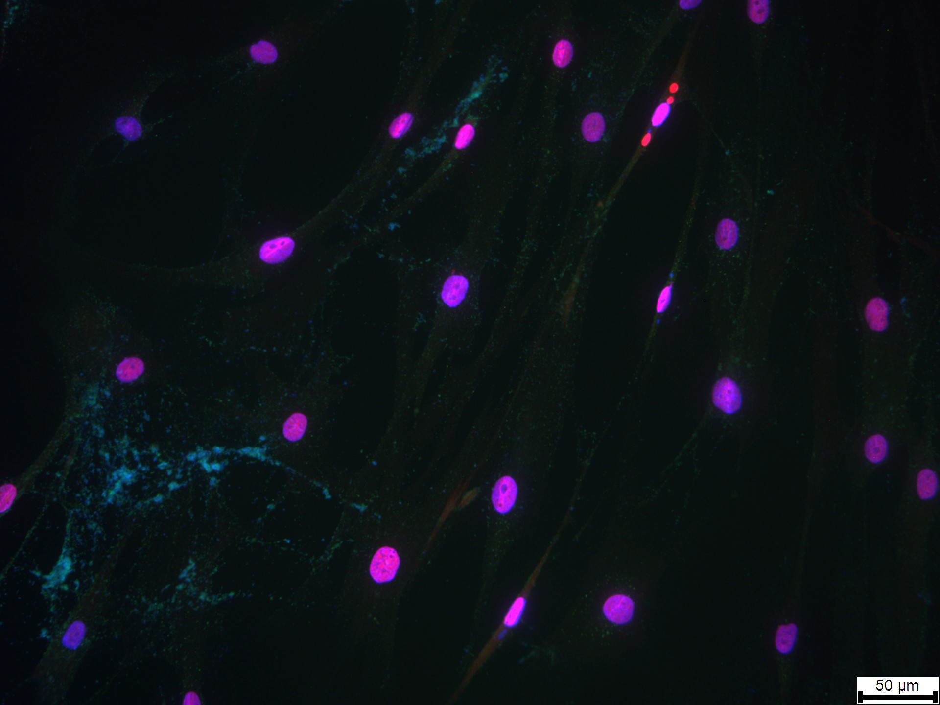 eLife's tweet card. The growth factor PDGF can halt cell ageing in intervertebral disc cells and may, in the future, be used to help stop the progression of degenerative disc disease.