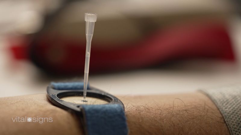 UCSDJacobs's tweet card. Researchers have discovered biomarkers in sweat that could play a role advancing everything from precision medicine and nutrition to diagnosing things like depression and anxiety.