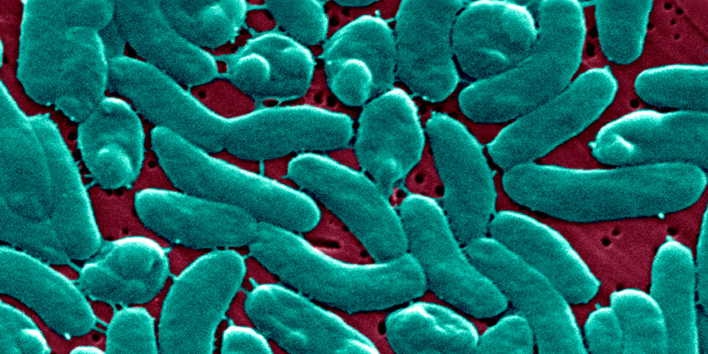 NBCNewsHealth's tweet card. The culprit, Vibrio vulnificus, thrives in warm seawater and can get into the body through open wounds in the skin.