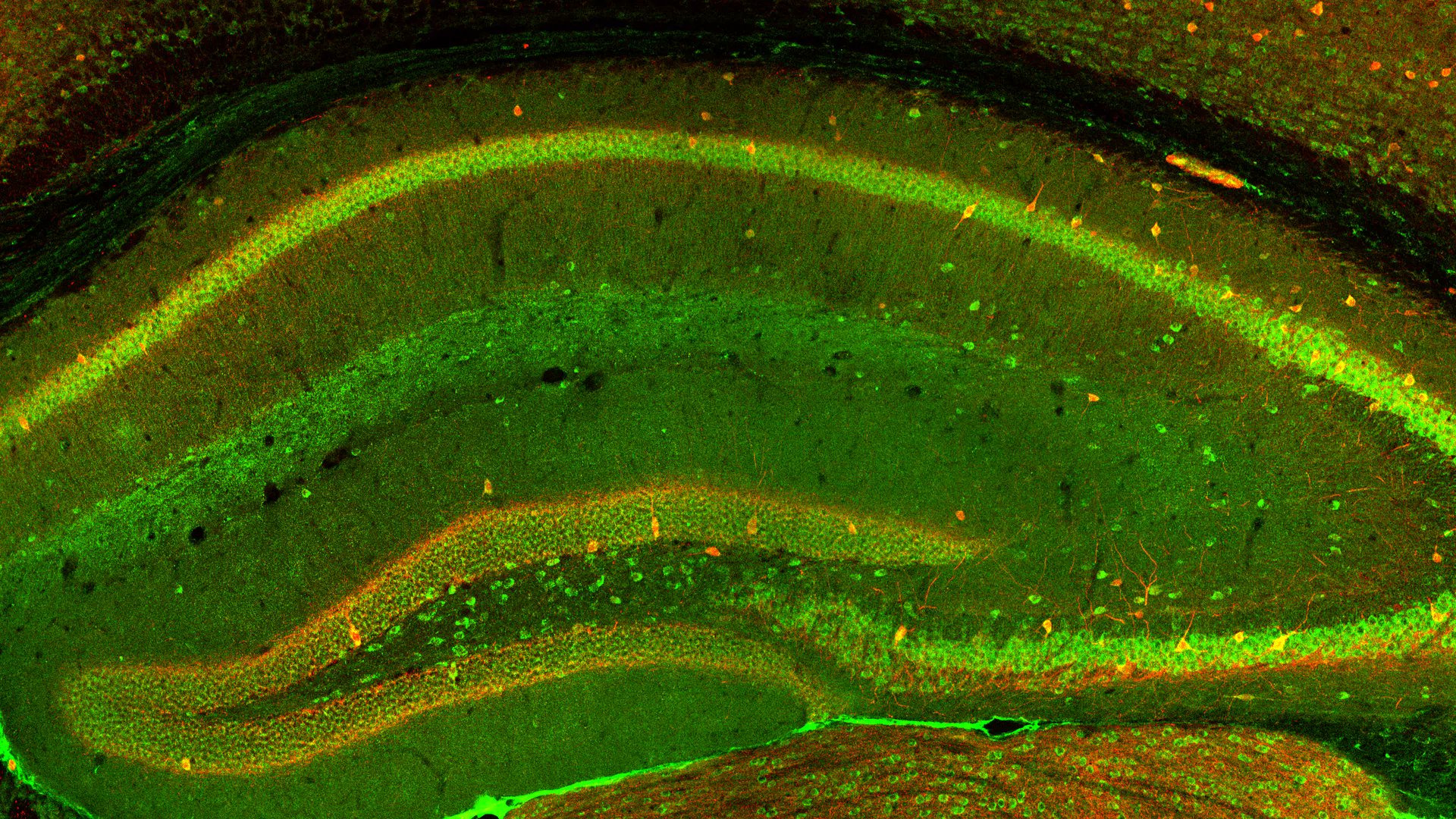 FrontNeurosci's tweet card. The precise clustering of ion channels at axon initial segments (AIS) and nodes of Ranvier is essential for axonal excitability and rapid action potential pr...