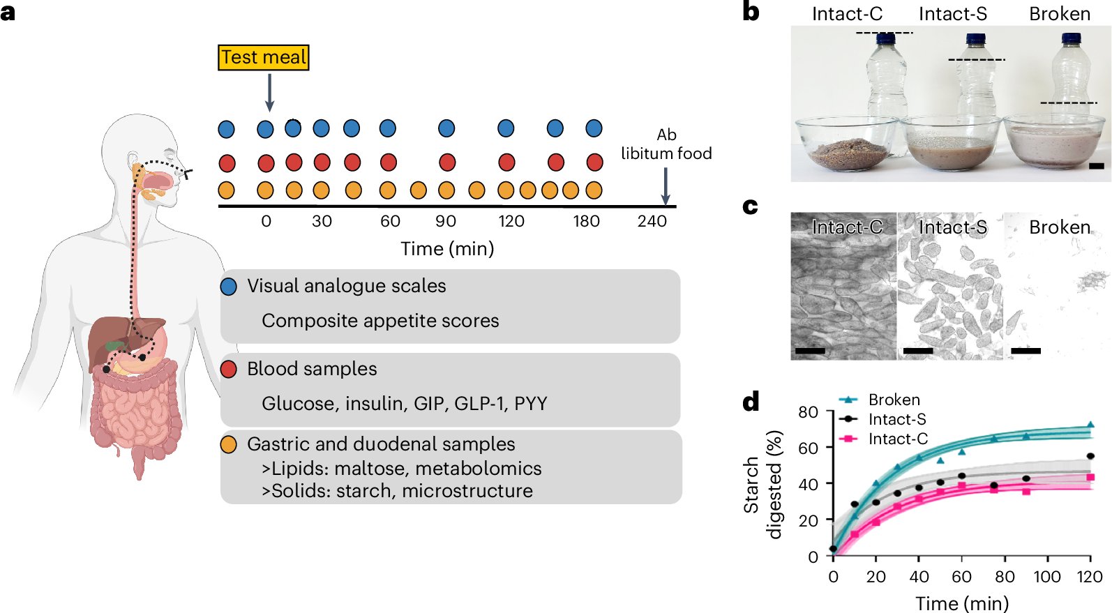 ktguzz's tweet card. Nature Metabolism - In this randomized crossover pilot study, the authors collected human gastrointestinal digesta using a unique intubation technique to compare how meals with contrasting cellular...