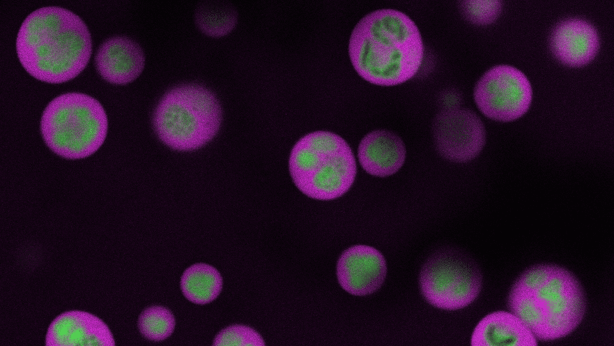 EPrinceton's tweet card. With a new mapping tool, Princeton engineers have revealed how a factory inside cells builds ribosomes, the machinery responsible for protein synthesis. The system opens the door to treatments and...