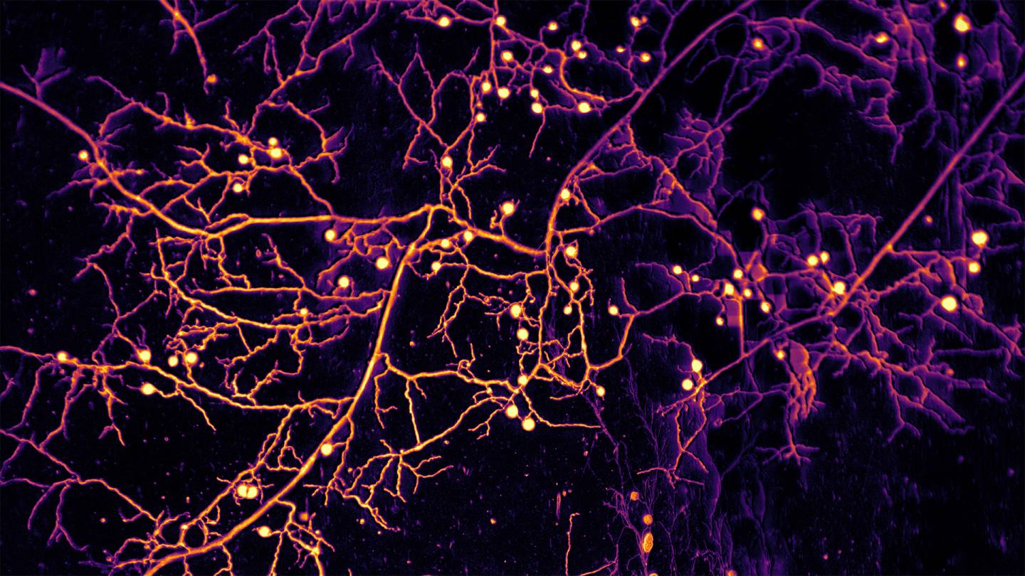 Princeton's tweet card. An international team including engineers from Princeton has devised a way to watch, in stunning detail, as the hollow tendrils of fungi forage for nutrients and then transport those nutrients to the...