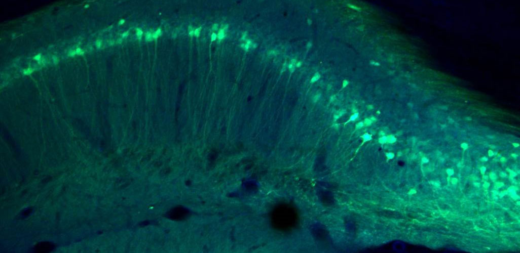 WahlNeuroLab's tweet card. The brain is different compared to other organs in various aspects, including its regenerative capacities: Traditionally it was believed, that the hardware of the brain is “that hard” that once the...