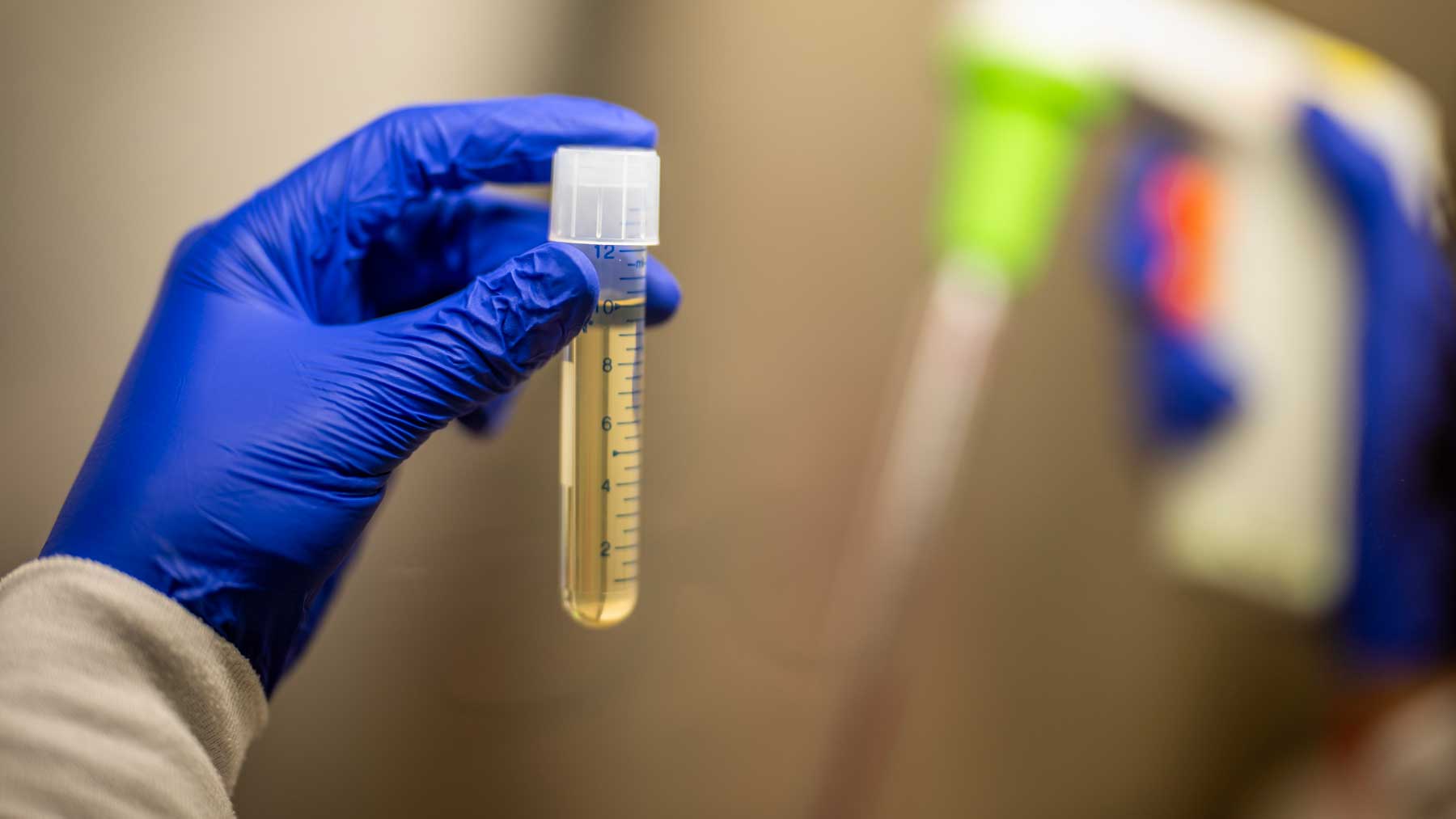 UCSF's tweet card. UCSF researchers have found clues about how frontotemporal dementia develops that could lead to new diagnostics and get more patients into clinical trials.