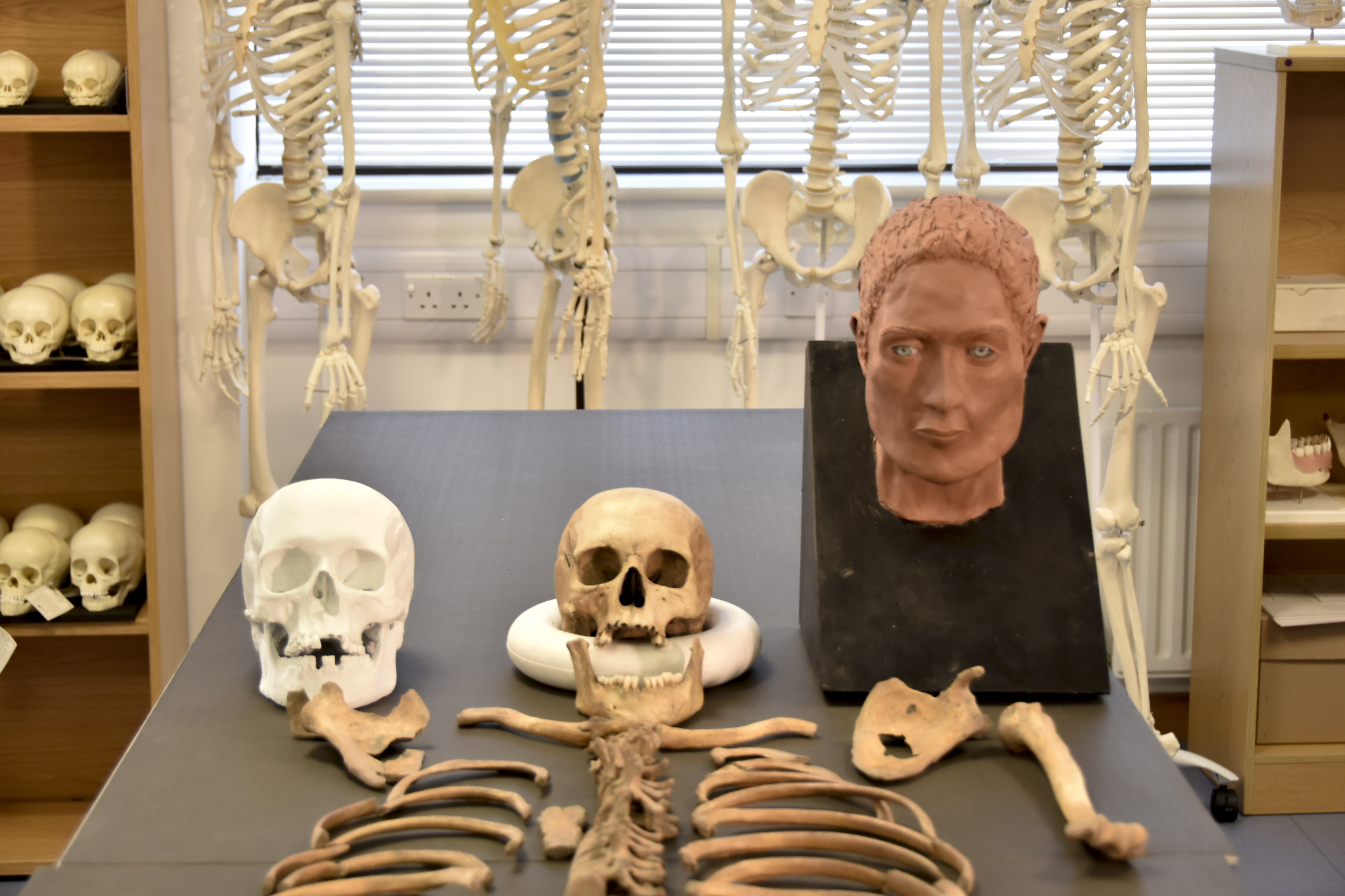 CurrentArchaeo's tweet card. The face and head of an Iron Age woman whose remains were discovered in Dorset’s Kimmeridge Bay 25 years ago have been reconstructed by an MSc Bioarchaeolog ...