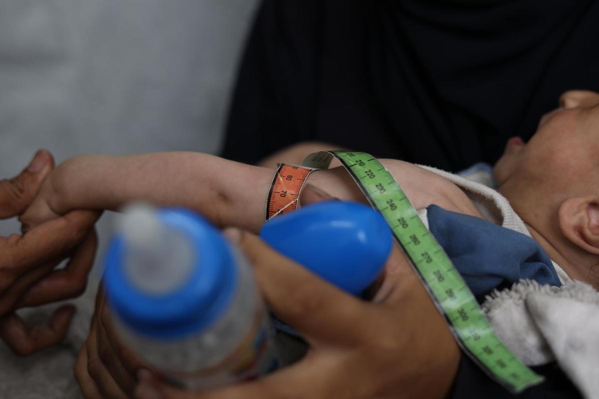 MSF_france's tweet card. Les équipes de Médecins Sans Frontières (MSF) ont constaté une augmentation soudaine et conséquente des taux de malnutrition aiguë chez les patients de la clinique MSF d’Al-Mawasi, dans le sud de la...