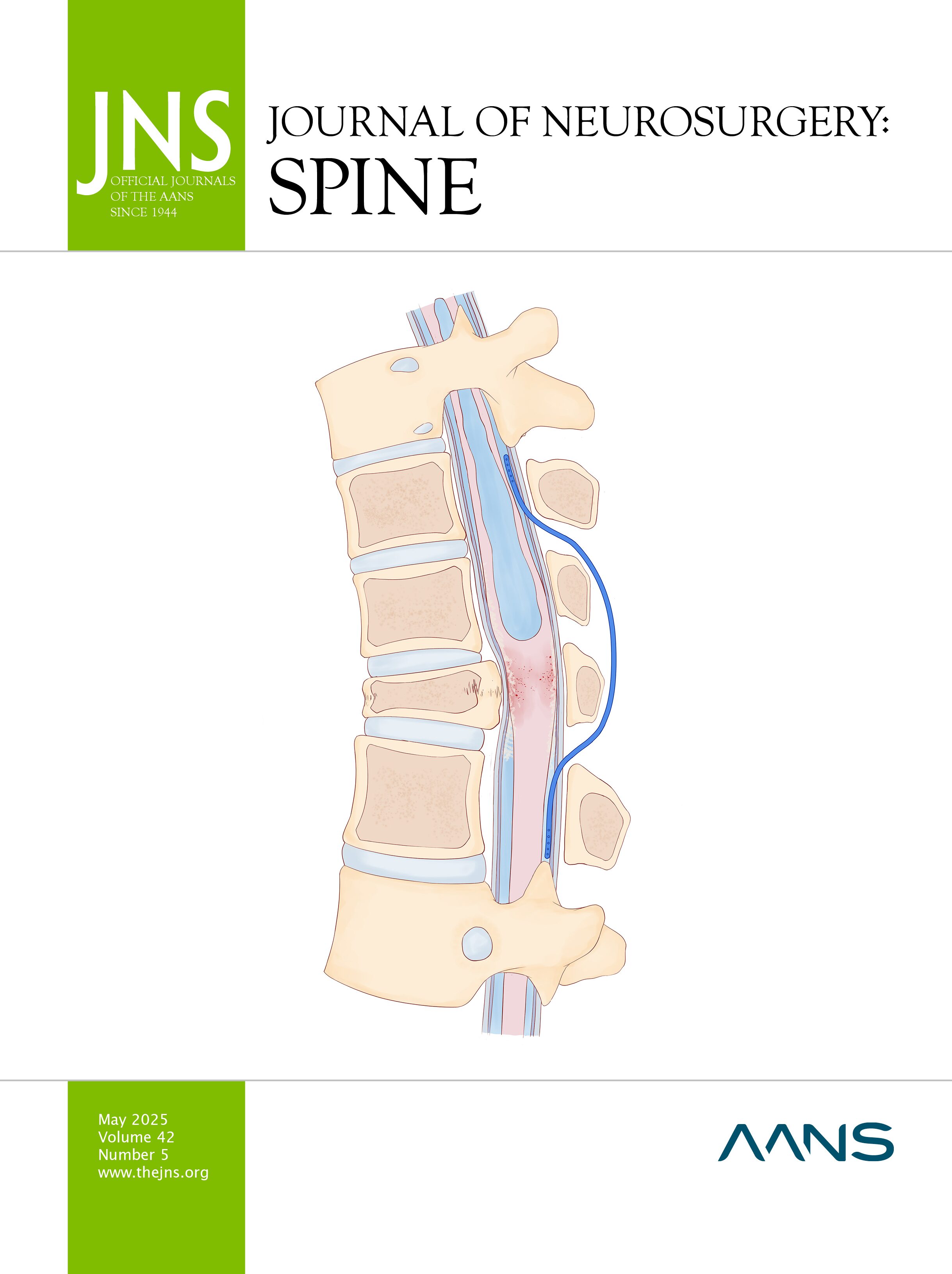 shaharshal99's tweet card. OBJECTIVE Tethered cord syndrome (TCS) is a significant cause of debilitation in patients with spinal dysraphisms or tumors. Management of TCS has historically centered on intradural detethering...