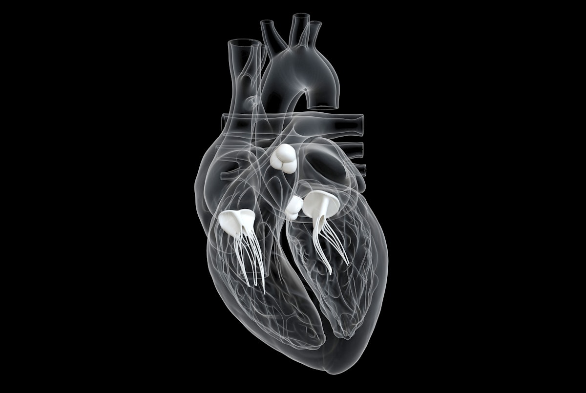 AuntMinnie's tweet card. A CCTA-based AI model demonstrated success in differentiating plaque volume among chest pain patients.